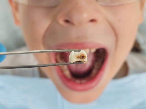 Best Pediatric Emergency Dentist in Oneonta, NY